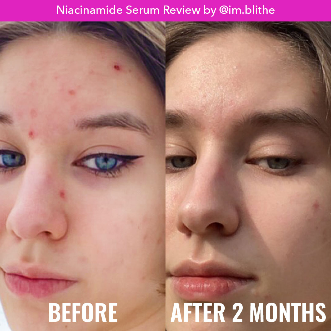 Good Molecules Sérum Niacinamide