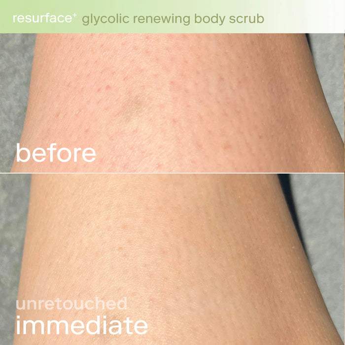 SKINFIX Resurface+ Glycolic and Lactic Acid Renewing Body Scrub