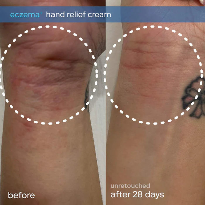 SKINFIX Eczema+ Ceramide Hand + Foot Relief Cream