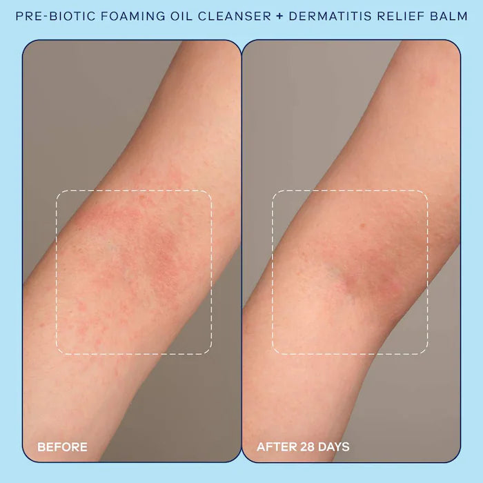 SKINFIX Eczema+ Pre-Biotic Foaming Oil Cleanser